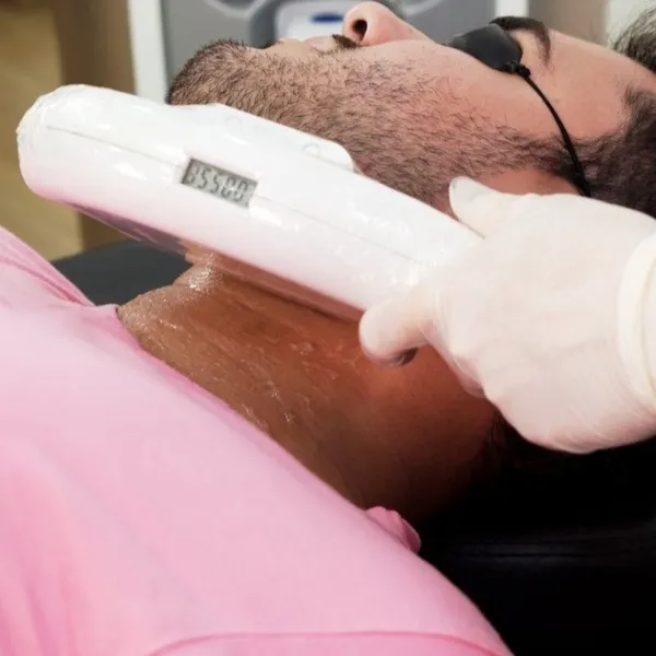 homem-depilacao-luz-pulsada-barba